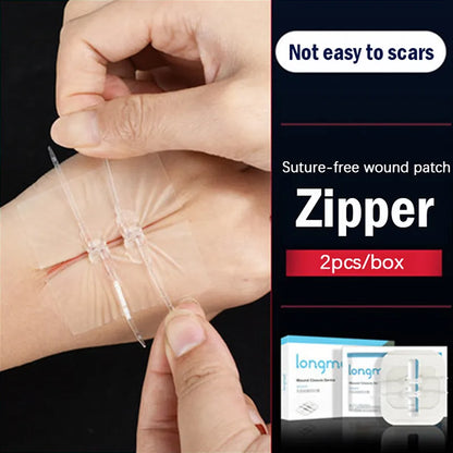 Painless Suture Adhesive Wound Closure Device